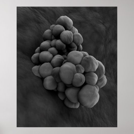 Microscopisch Uitzicht van tumor 1 Poster (Voorkant)