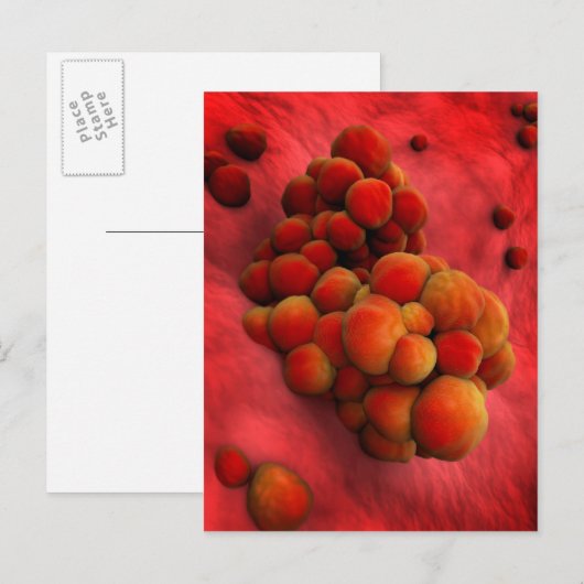 Microscopisch Uitzicht van tumor 2 Briefkaart (Voorkant / Achterkant)