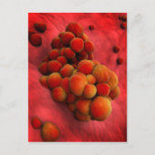 Microscopisch Uitzicht van tumor 2 Briefkaart (Voorkant)