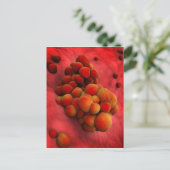 Microscopisch Uitzicht van tumor 2 Briefkaart (Staand voorkant)