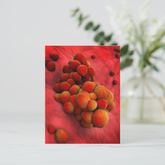 Microscopisch Uitzicht van tumor 2 Briefkaart (Staand voorkant)