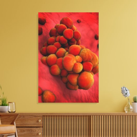 Microscopisch Uitzicht van tumor 2 Canvas Afdruk (Insitu (Woonkamer))