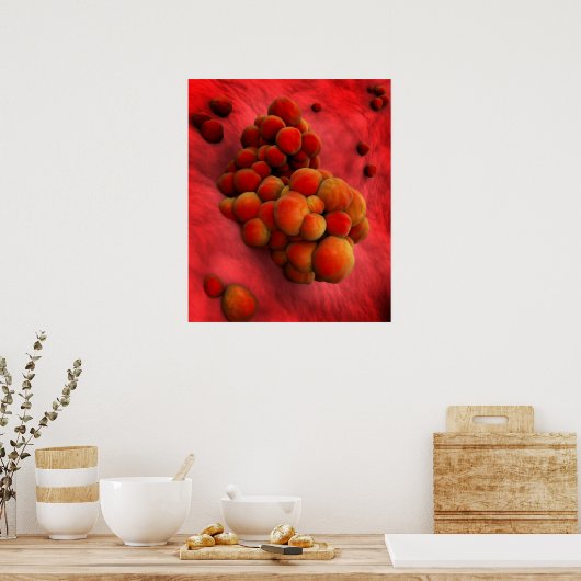 Microscopisch Uitzicht van tumor 2 Poster (Keuken)