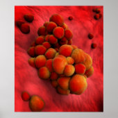 Microscopisch Uitzicht van tumor 2 Poster (Voorkant)