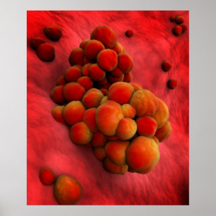 Microscopisch Uitzicht van tumor 2 Poster