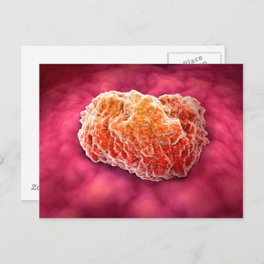 Microscopisch Uitzicht van tumor 3 Briefkaart (Voorkant / Achterkant)