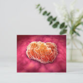 Microscopisch Uitzicht van tumor 3 Briefkaart (Staand voorkant)