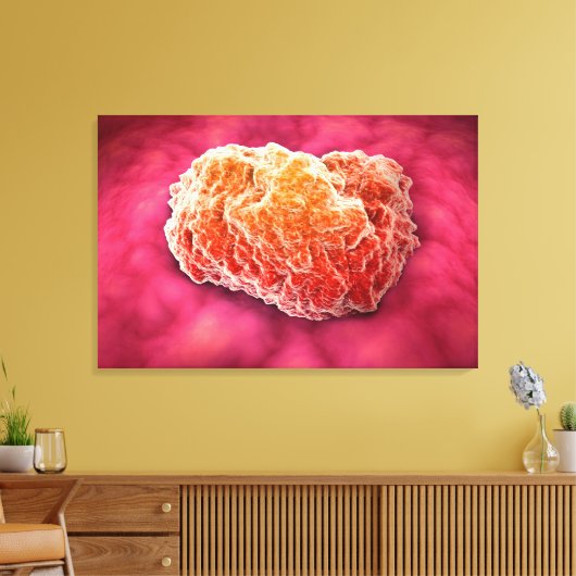 Microscopisch Uitzicht van tumor 3 Canvas Afdruk (Insitu (Woonkamer))