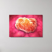 Microscopisch Uitzicht van tumor 3 Canvas Afdruk (Voorkant)