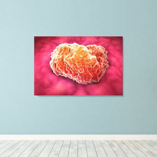 Microscopisch Uitzicht van tumor 3 Canvas Afdruk (Insitu (Houten vloer))
