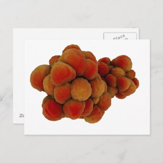 Microscopisch Uitzicht van tumor 4 Briefkaart (Voorkant / Achterkant)