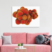 Microscopisch Uitzicht van tumor 4 Canvas Afdruk (Insitu (Woonkamer))