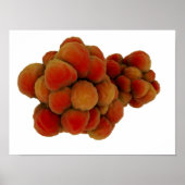 Microscopisch Uitzicht van tumor 4 Poster (Voorkant)