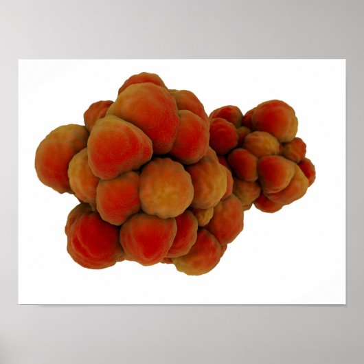 Microscopisch Uitzicht van tumor 4 Poster (Voorkant)