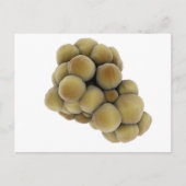 Microscopisch Uitzicht van tumor 5 Briefkaart (Voorkant)