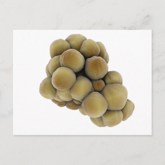 Microscopisch Uitzicht van tumor 5 Briefkaart (Voorkant)