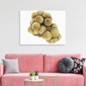 Microscopisch Uitzicht van tumor 5 Canvas Afdruk (Insitu (Woonkamer))