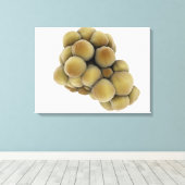 Microscopisch Uitzicht van tumor 5 Canvas Afdruk (Insitu (Houten vloer))