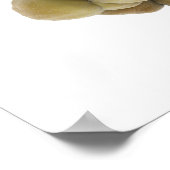 Microscopisch Uitzicht van tumor 5 Poster (Hoek)