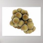 Microscopisch Uitzicht van tumor 5 Poster (Voorkant)