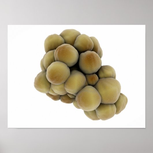 Microscopisch Uitzicht van tumor 5 Poster (Voorkant)