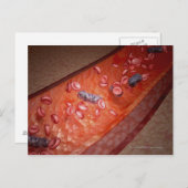 Microscopische weergave van een bloedinfectie briefkaart (Voorkant / Achterkant)