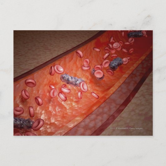 Microscopische weergave van een bloedinfectie briefkaart (Voorkant)