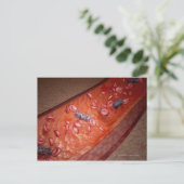 Microscopische weergave van een bloedinfectie briefkaart (Staand voorkant)