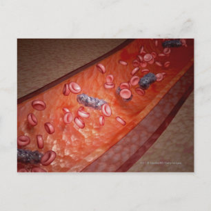 Microscopische weergave van een bloedinfectie briefkaart