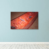 Microscopische weergave van een bloedinfectie canvas afdruk (Insitu (Houten vloer))