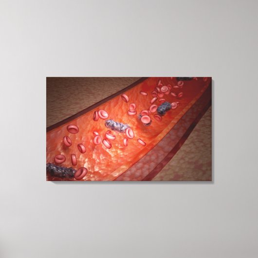 Microscopische weergave van een bloedinfectie canvas afdruk (Voorkant)