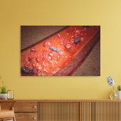 Microscopische weergave van een bloedinfectie canvas afdruk (Insitu (Woonkamer))