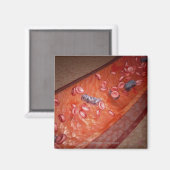 Microscopische weergave van een bloedinfectie magneet (Voorkant / Achterkant)