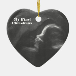 Mijn eerste kerstrecyclebare Baby Scan Keramisch Ornament