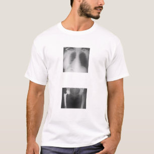 Mijn heup heeft net gekraakt van verdriet. t-shirt