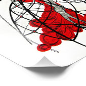 Mijn Iron Lung Foto Afdruk (Hoek)