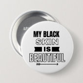 Mijn zwarte huid is een mooie Button (Voorkant /achterkant)