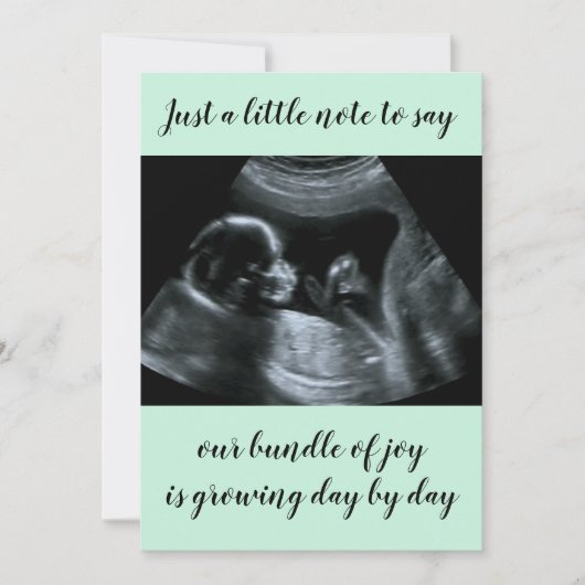 Mint Green Custom Sonogram Foto Zwangerschap Aankondiging (Voorkant)