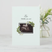 Mint Ultrasound Foto Dank u Baby Punt van Uitzicht Bedankkaart (Staand voorkant)