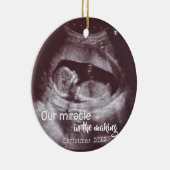 Mirakel in het maken van Ultrasound 2 Foto Baby ko Keramisch Ornament (Rechts)