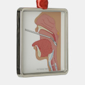 Mirror Laryngoscopie Metalen Ornament (Rechts)