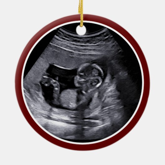 Miskraam / Baby Verlies Memorial echografie Foto Keramisch Ornament (Achterkant)