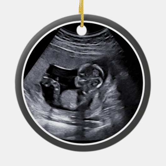 Miskraam / Baby Verlies Memorial echografie Foto Keramisch Ornament (Achterkant)