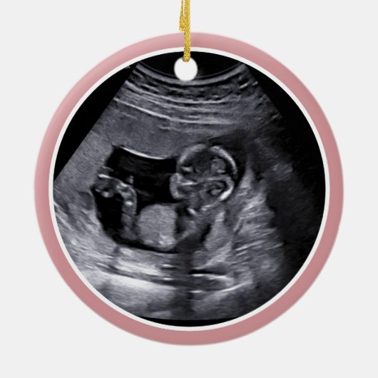 Miskraam / Baby Verlies Memorial Kerstmis Keramisch Ornament (Achterkant)