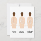 Misvorming wervelkolom notitiekaartje (Voorkant)