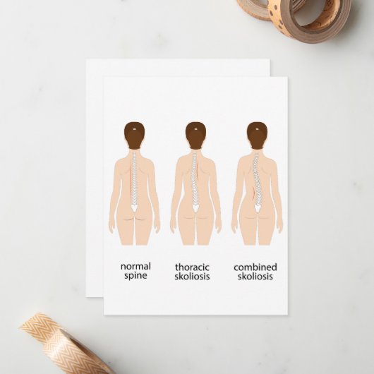 Misvorming wervelkolom notitiekaartje (Voorkant / Achterkant in situ)