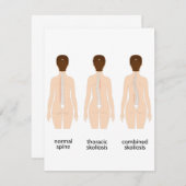 Misvorming wervelkolom notitiekaartje (Voorkant / Achterkant)