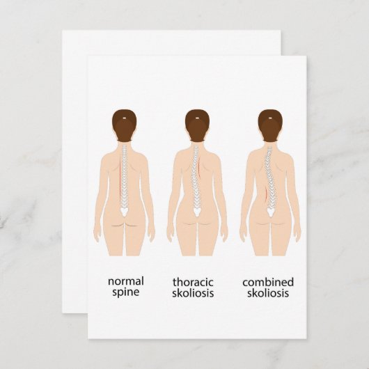 Misvorming wervelkolom notitiekaartje (Voorkant / Achterkant)