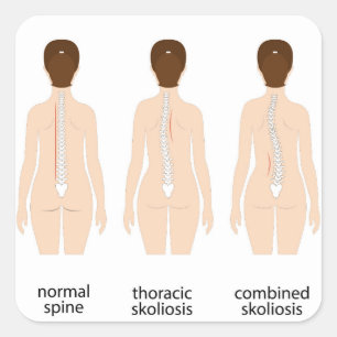 Misvorming wervelkolom vierkante sticker