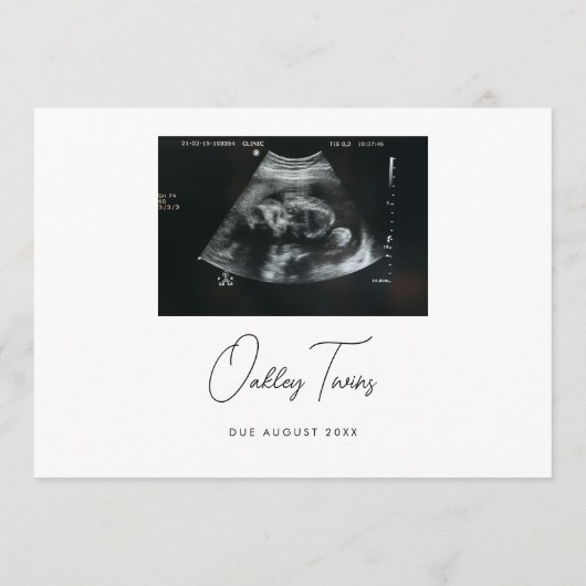Modern Script Twins Minimalistic Baby Pregnancy Aankondiging (Achterkant)